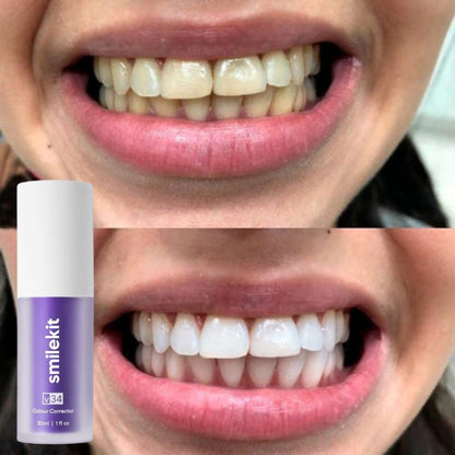 SmileKit V34 | Tus dientes más blancos
